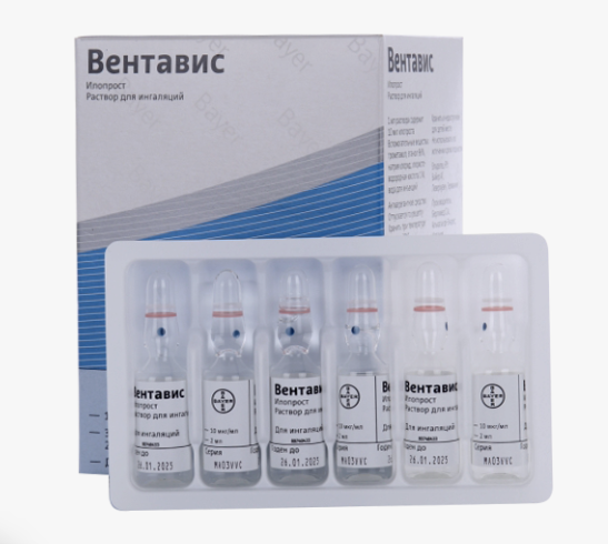 Вентавис